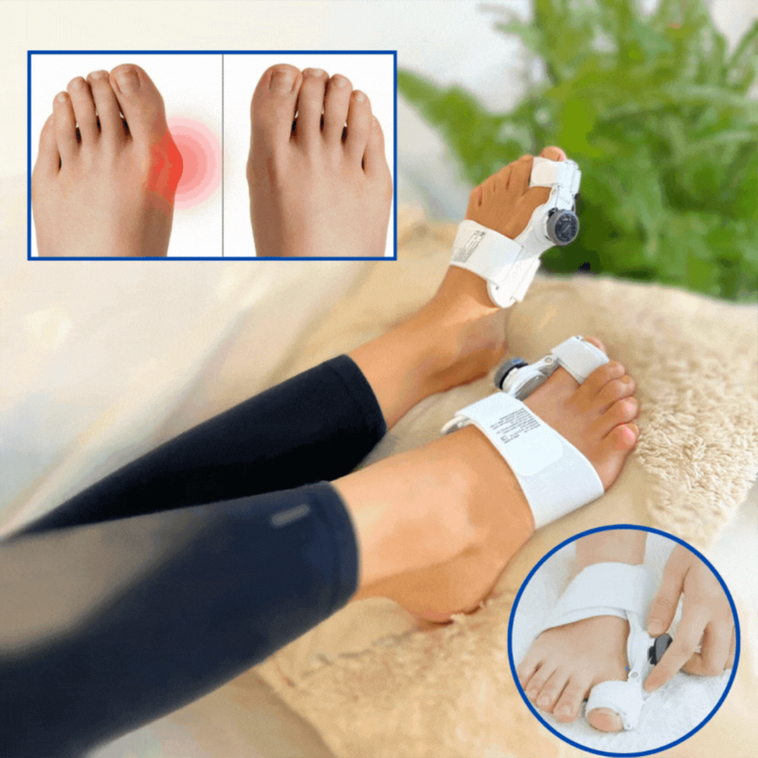 ComfortFeet™ | Beseitigen Sie Hallux valgus in weniger als 27 Tagen!