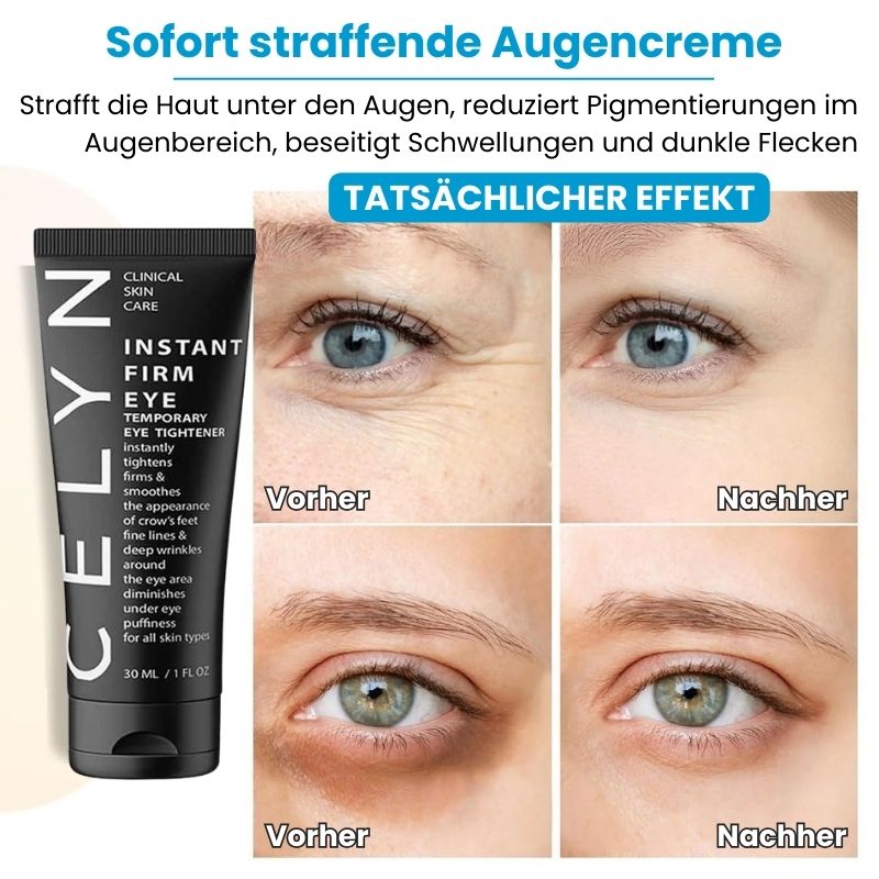 EyeFirm™ - Creme | Reduziert Schwellungen und Fältchen in 5 Minuten
