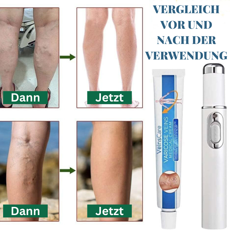 VaricoseKlar™ | Vollständige Beseitigung von Krampfadern in nur 4 Wochen!