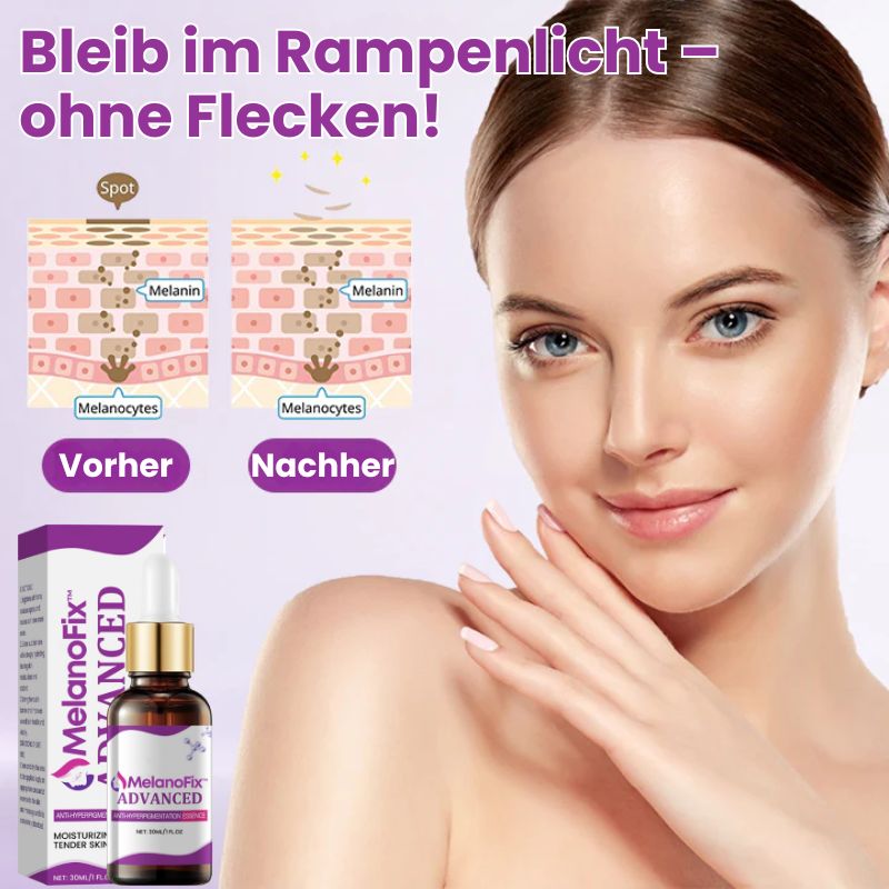 MelanoFix™ | Anti-Hyperpigmentierungsserum