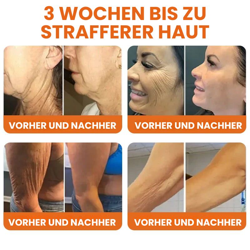 BienenStraff™ | Straffender Stick