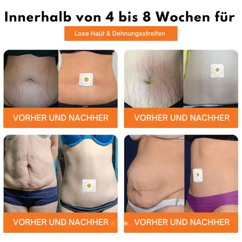 BienenDetox™ | Bienengift Schlankheitspflaster