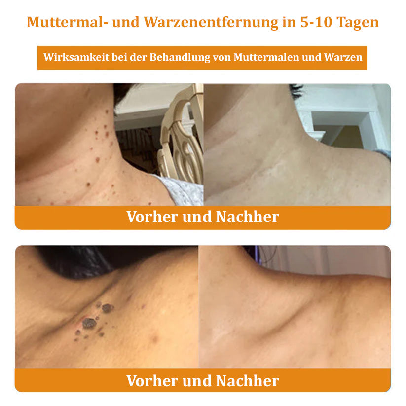 Dermatest-Zertifizierung | ApisGlow™ Bienengift-Hautcreme Bienengift-Hautcreme (BfArM empfohlen) (LETZTER TAG 70% RABATT)