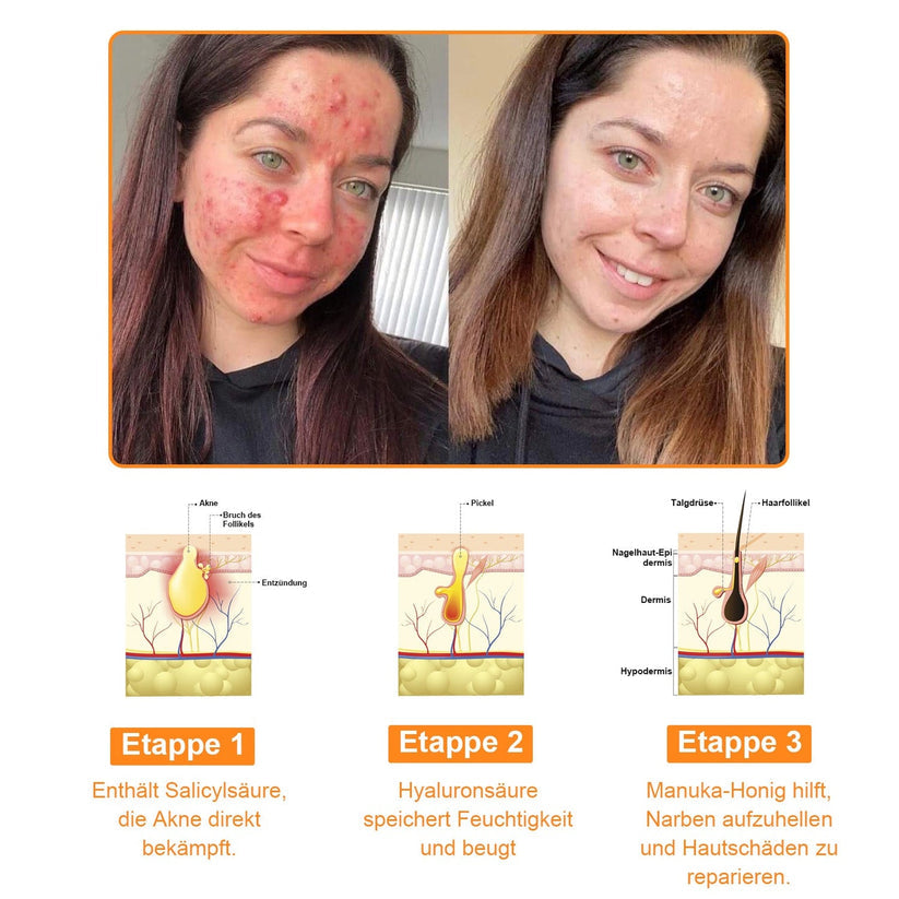 HautRepar™ | Leistungsstarke Ganzkörper-Hautpflegecreme (EADV-Empfehlungen)
