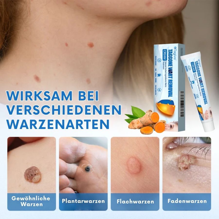 Tagiva™ | TagGone Warzenentfernungscreme