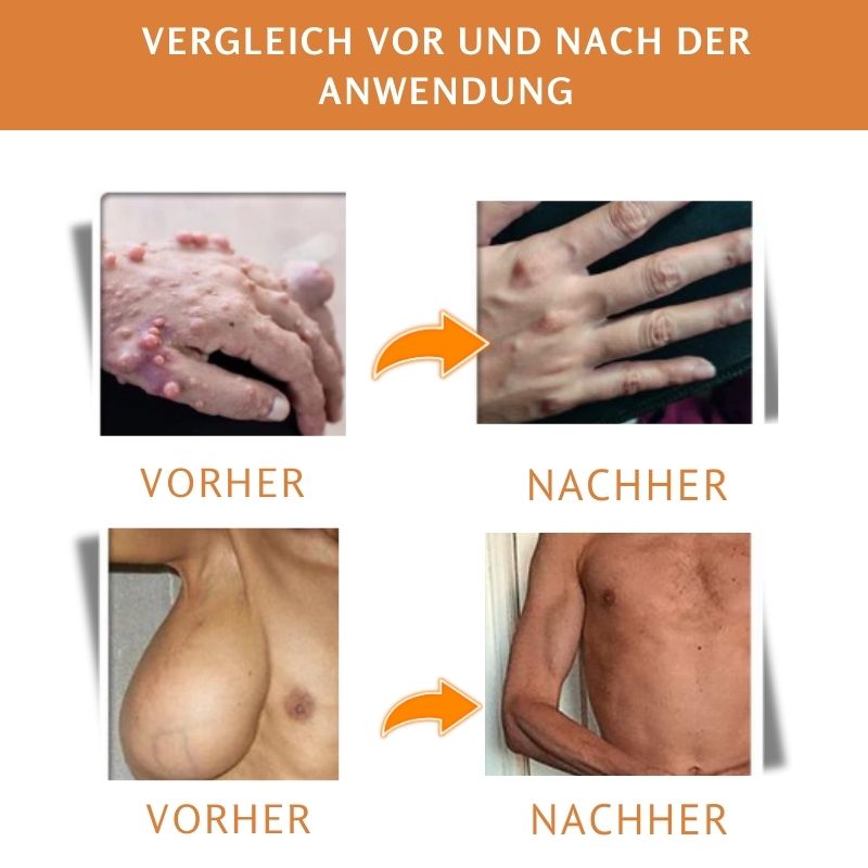 TagKlar™ |  Tags & Klumpen entfernen Gel