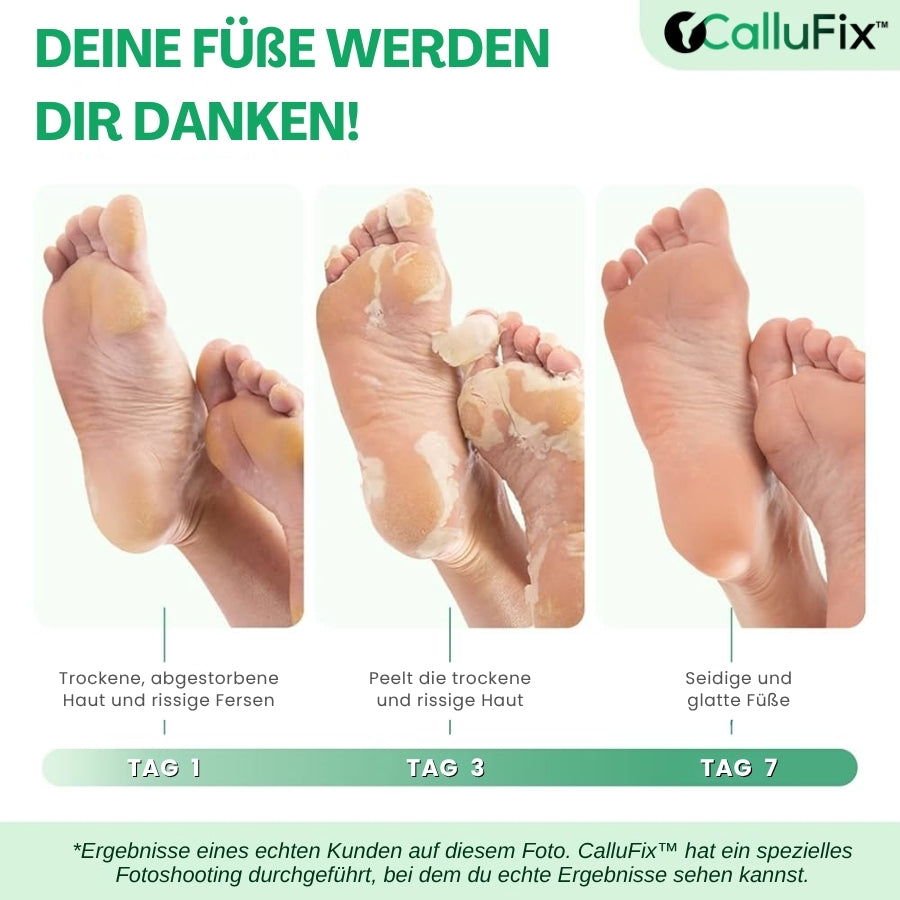 CalluFix™ | Aktives Hornhautentferner-Gel
