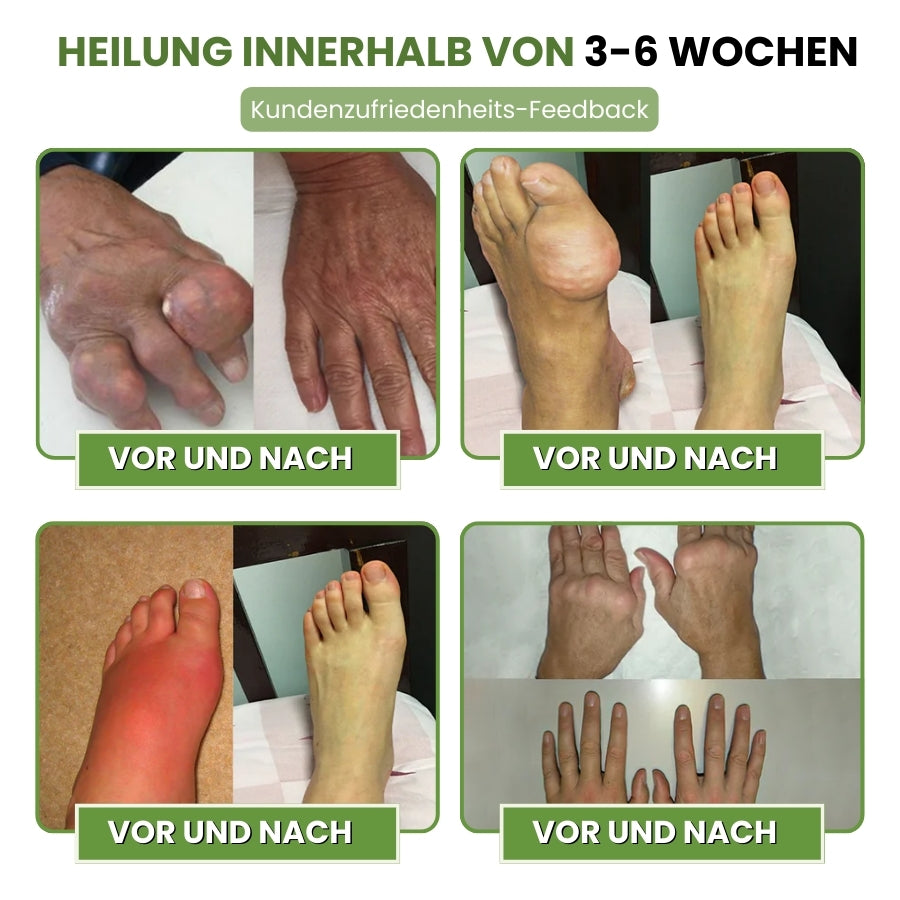 VenoJoint™ | Bienenstichgift-Gelenkregenerierungscreme