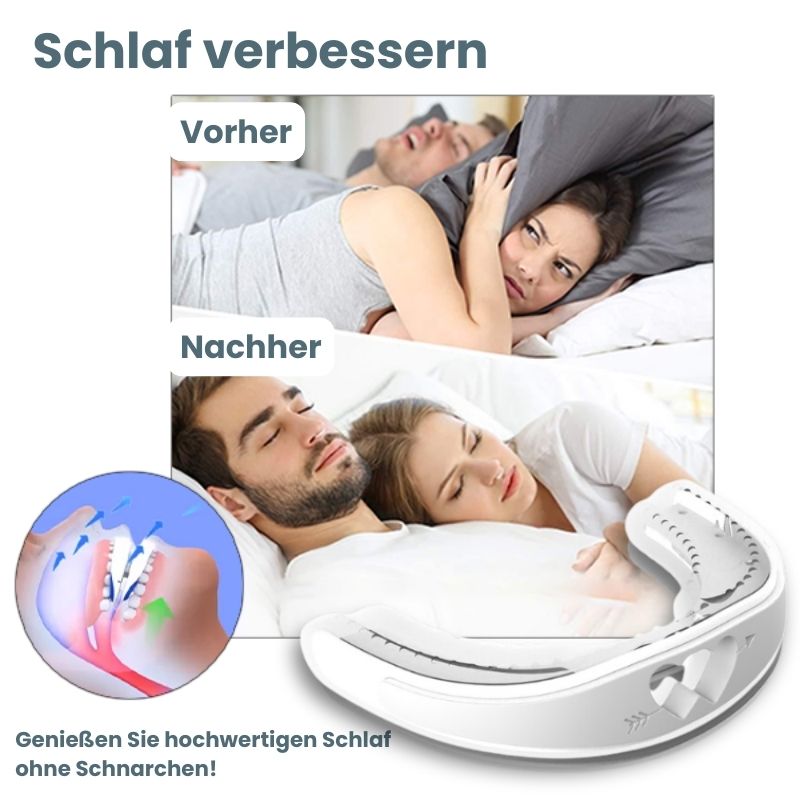 StilleNight™ | Apnea Oral Appliances