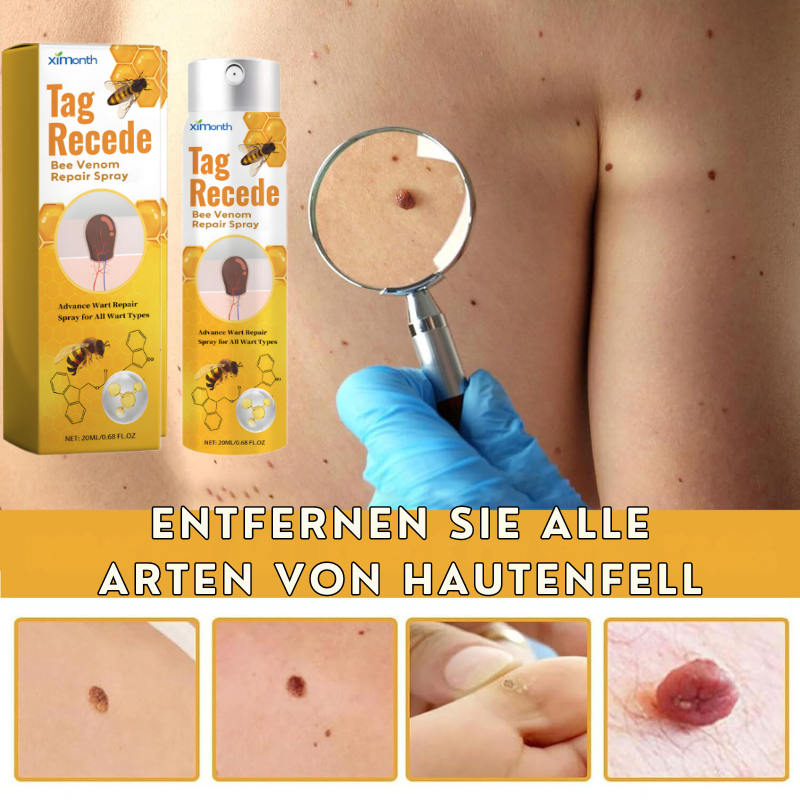 WarzenFrei™ | Verabschieden sich in nur 1 Woche von Hautflecken!