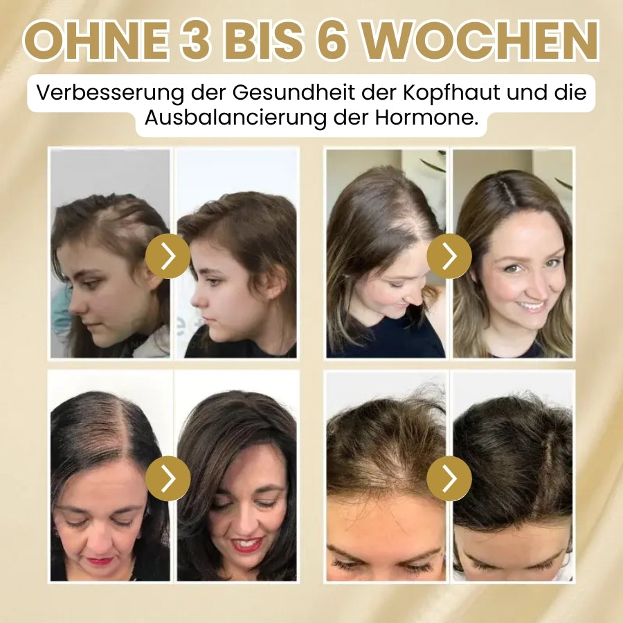 HaarKraft™ | Haarserum gegen Haarausfal