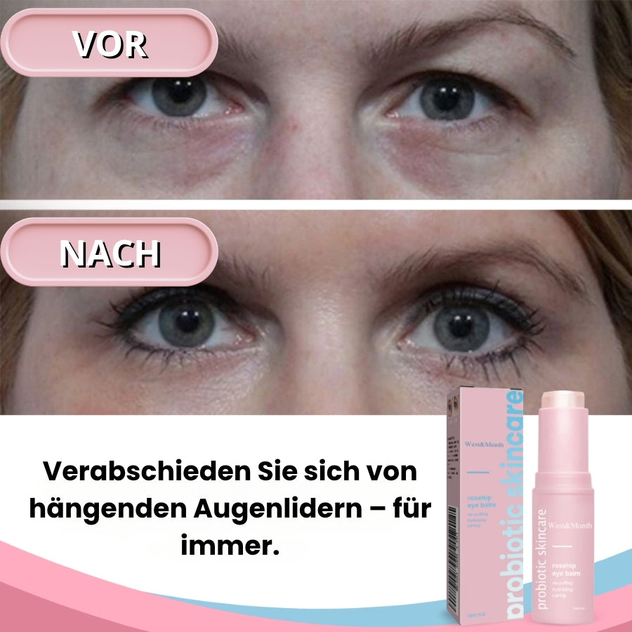 GlowBalm™ | Hagebutten Augenbalsam