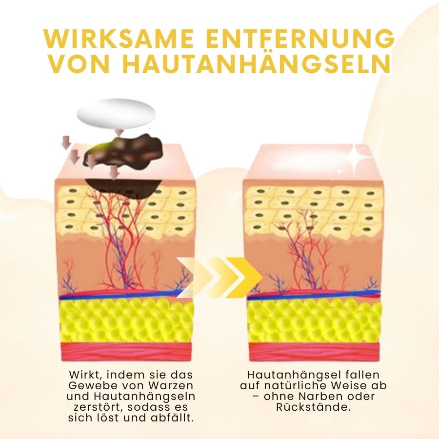 BeeKlar™ | Bienengift Hautanhängsel-Entferner Pflaster