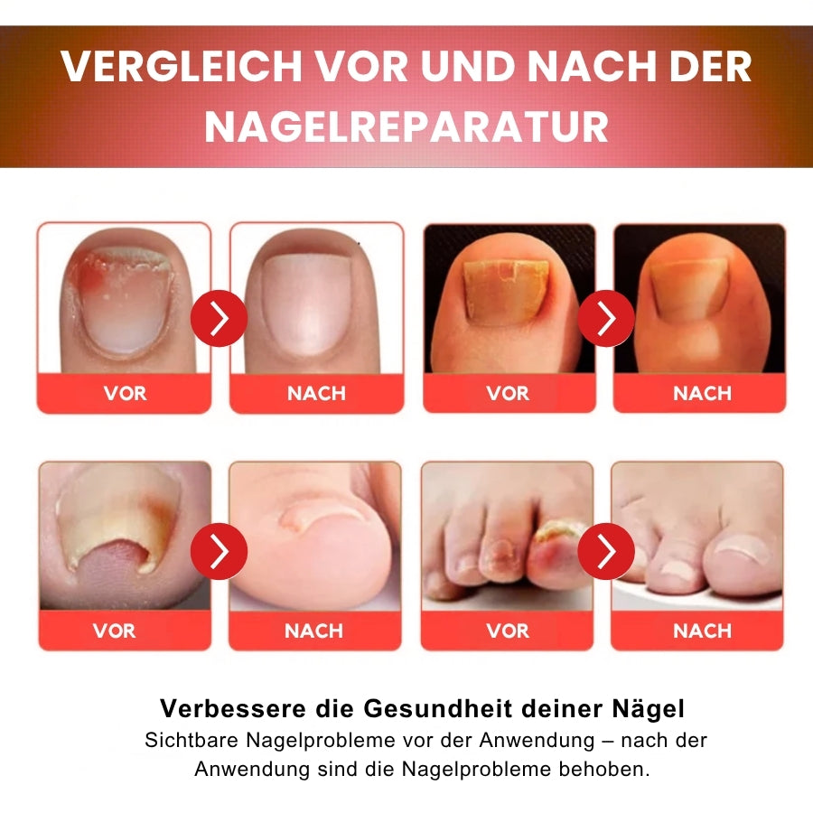 NailZen™ | Hagebuttenöl Nagelbehandlung