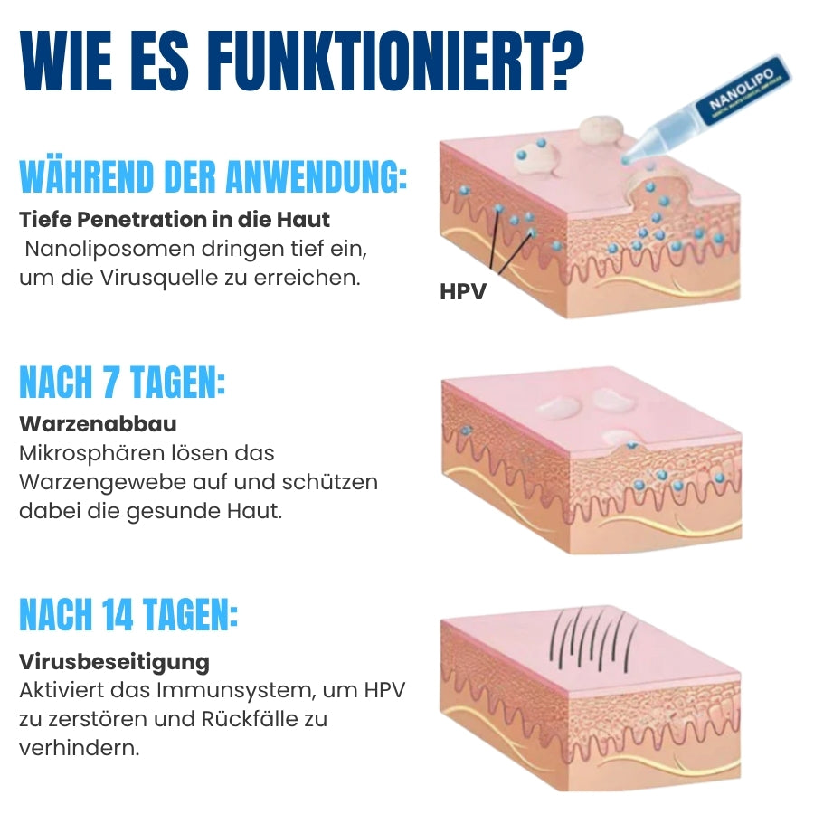NanoWart™ | Diskrete, wartauflösende Ampullen