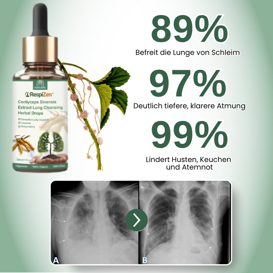 RespiZen™ | Lungen-Support-Tropfen