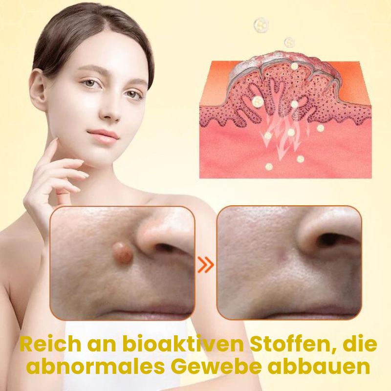 WarzenFix™ | Bienenstich-Reparatur- und Feuchtigkeitscreme