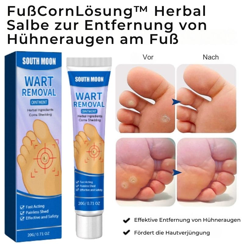 FußCornLösung™ | Kräuter-Fußschwielenentfernungssalbe