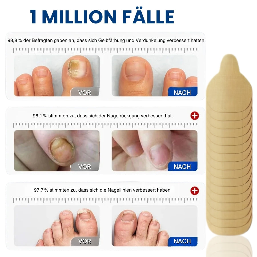 NailProtec™ | Nagelpilz Pflaster