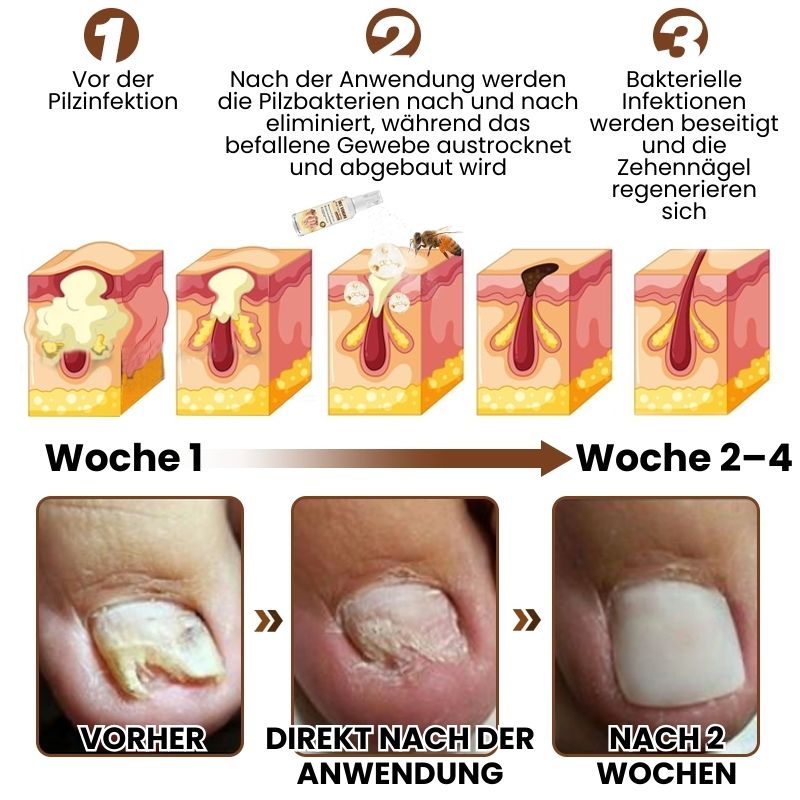 FungaBee® | Nagelpflegespray mit Bienengift