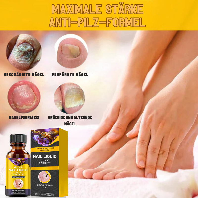 NagelPflege™ | Stellen Ihre hässlichen Nägel in nur 1 Woche wieder her!