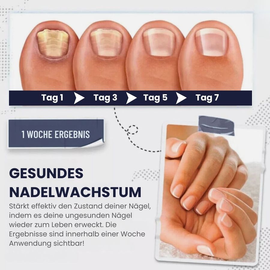 SwiftNail™ | Nagelreparatur-Serum