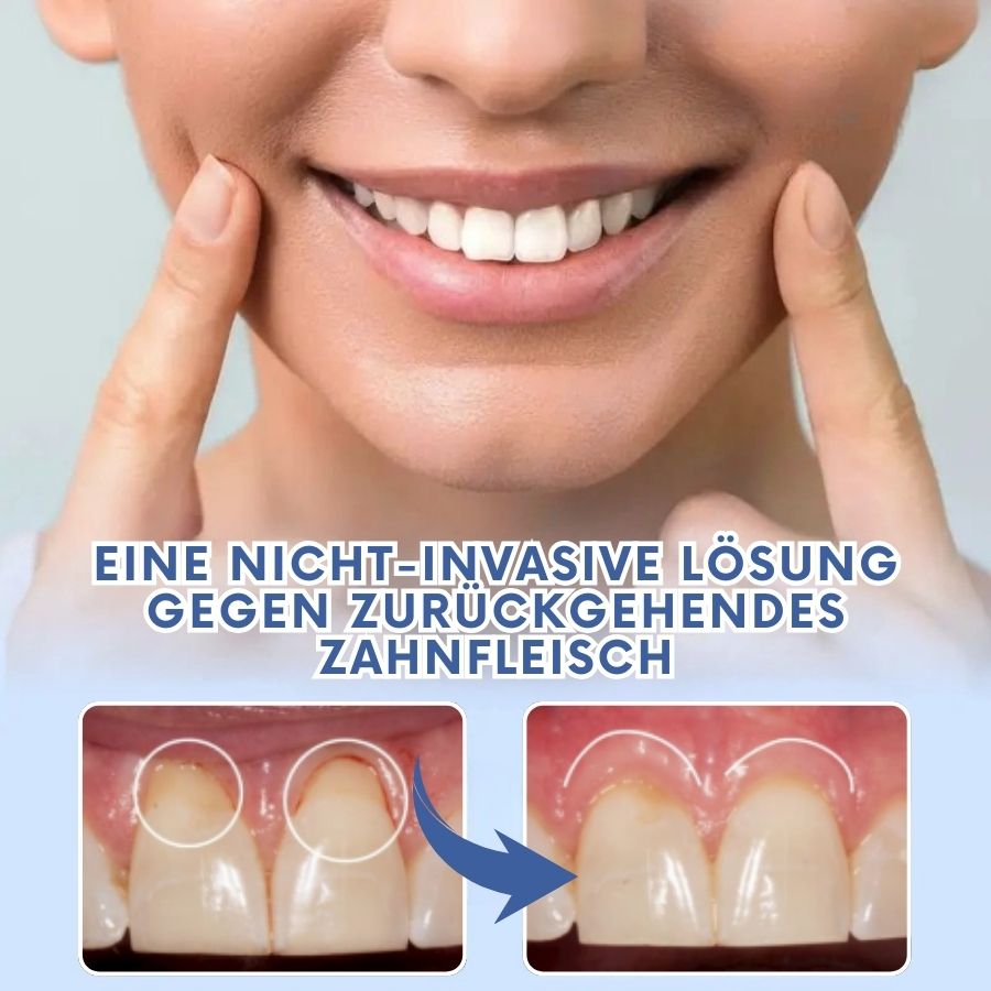 ReGum™ | Zahnfleisch Sofort-Beruhigungs-Gel