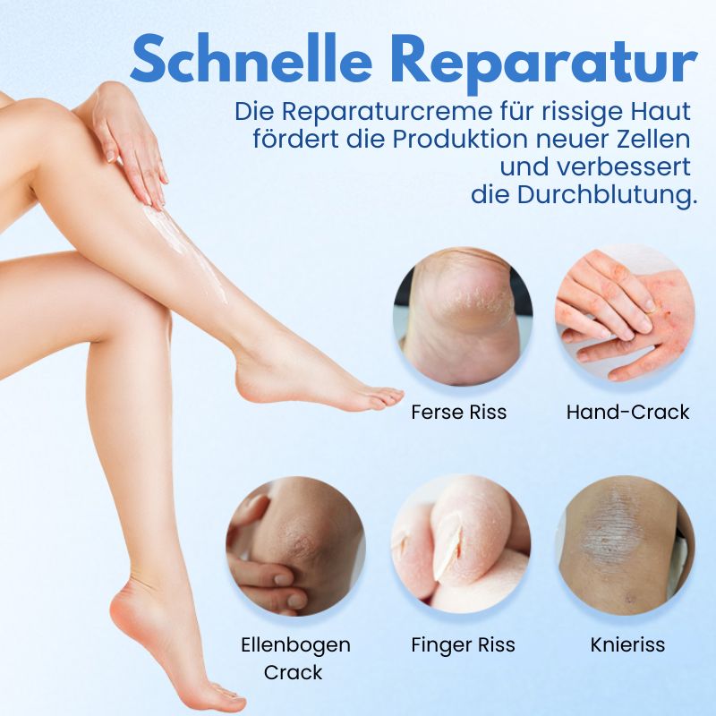 RisshautCreme™ | Creme zur Reparatur rissiger Haut