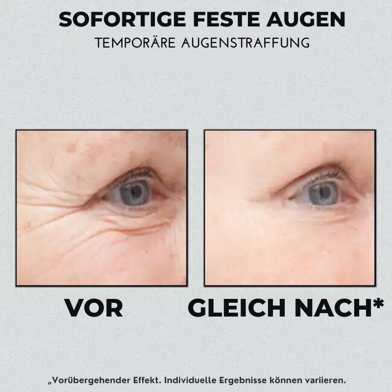 FirmCreme™ | Sofort straffende Creme für faltige Haut in nur 90 Sekunden!