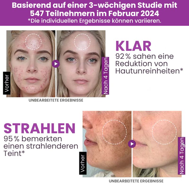MelanoFix™ | Anti-Hyperpigmentierungsserum