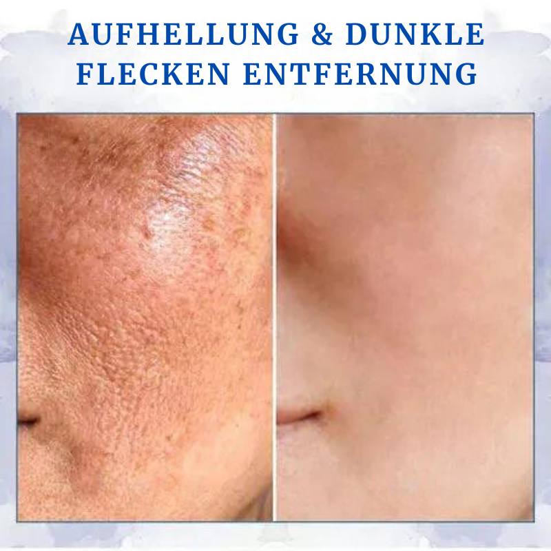 FaltenFrei™ | Fortschrittliche straffende & faltenreduzierende Creme in nur 7 Tagen!