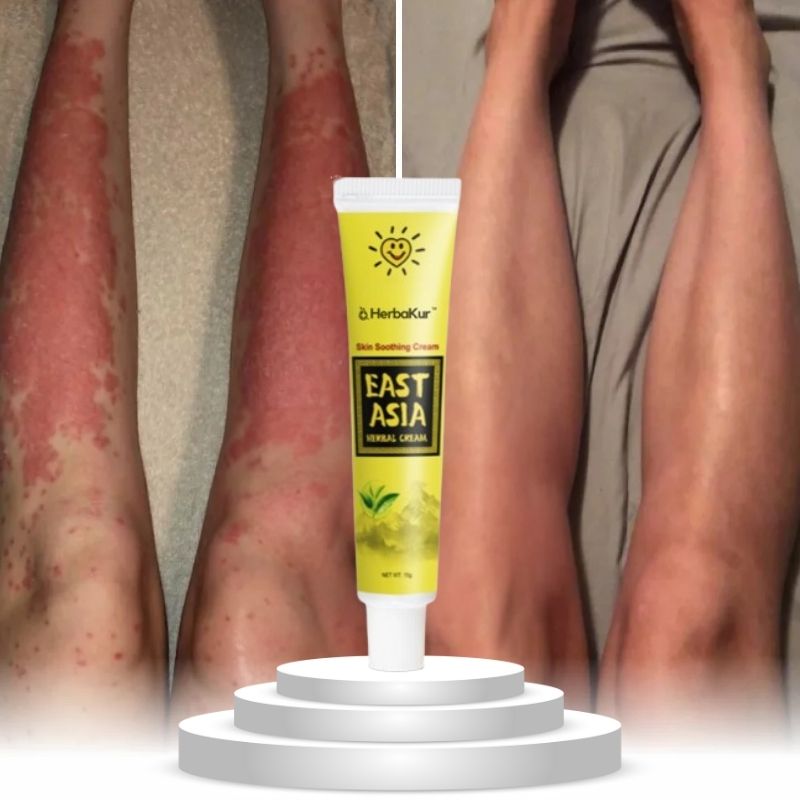 HerbaKur™ | Ekzem & Psoriasis Kräutercreme