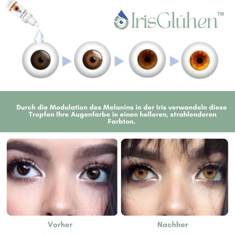 IrisGlühen™ |  Color Shift Augentropfen