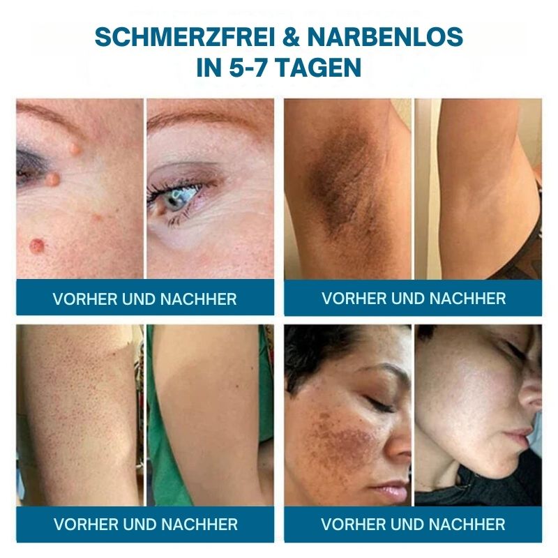 BeeLinderung™ |  Multi-Symptom-Bienengift-Behandlungscreme