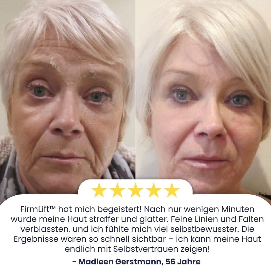FirmLift™ |  Faltenentferner-Creme
