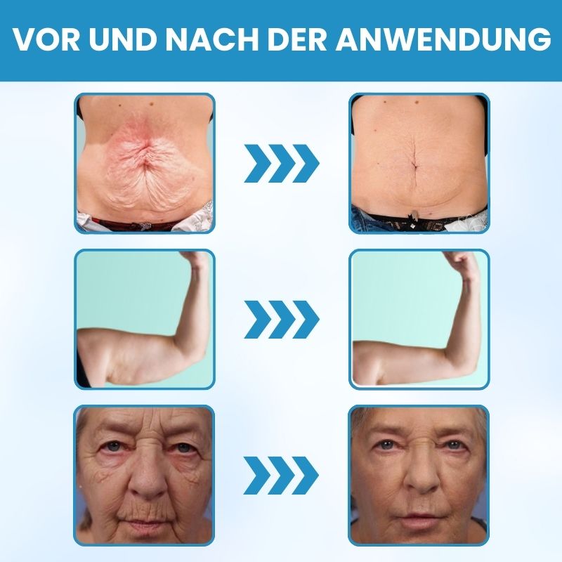 SkinRevive™ | Strafft die Haut in 72 Stunden