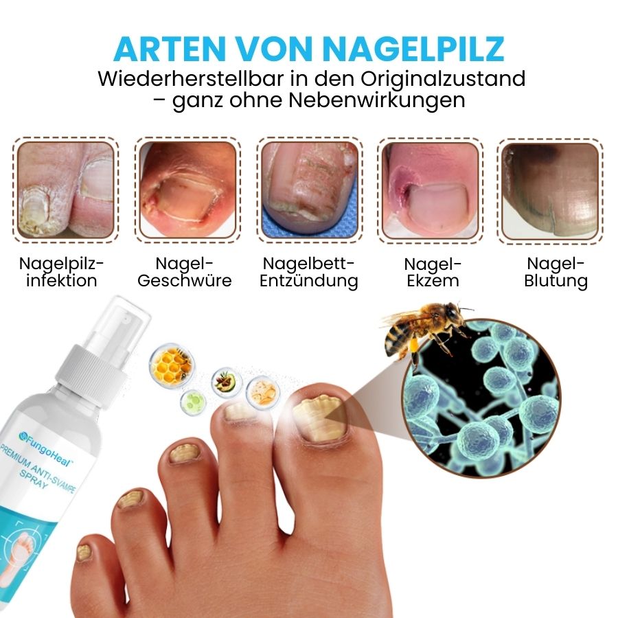 FungoHeal™ | Hochwertiges Antipilz-Spray