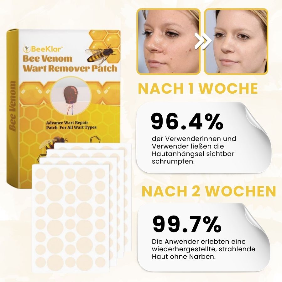 BeeKlar™ | Bienengift Hautanhängsel-Entferner Pflaster