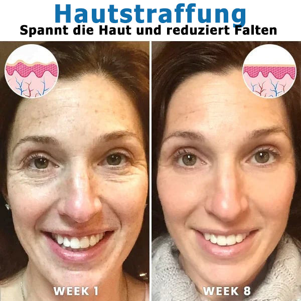VitalGlow™ | Botox-Gesichtsserum