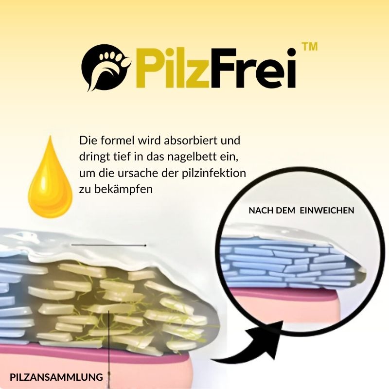 PilzFrei™ | Bienengift-Nagelpilz-Fußpflege einweichen