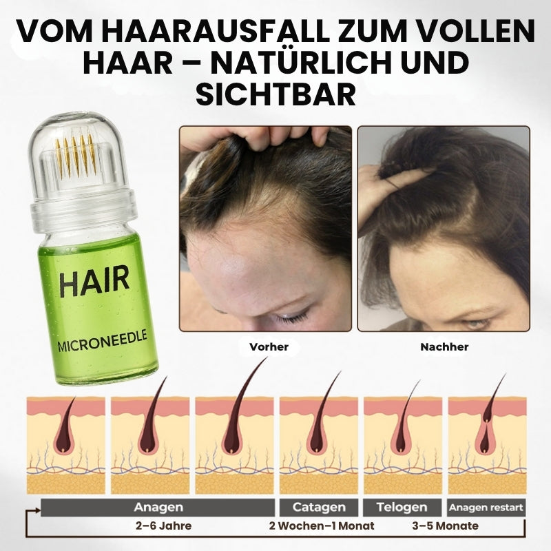 RootLuxe™ | Mikronadel-Haarwuchs-Set