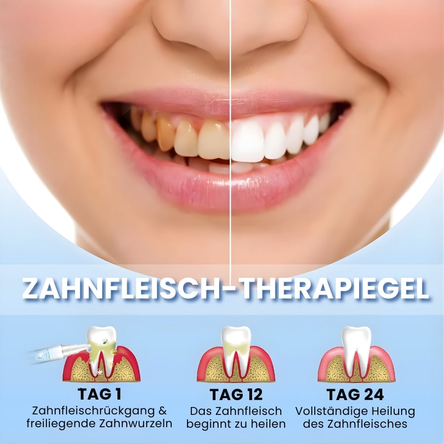 GumRevive™ | Zahnreparatur-Gel