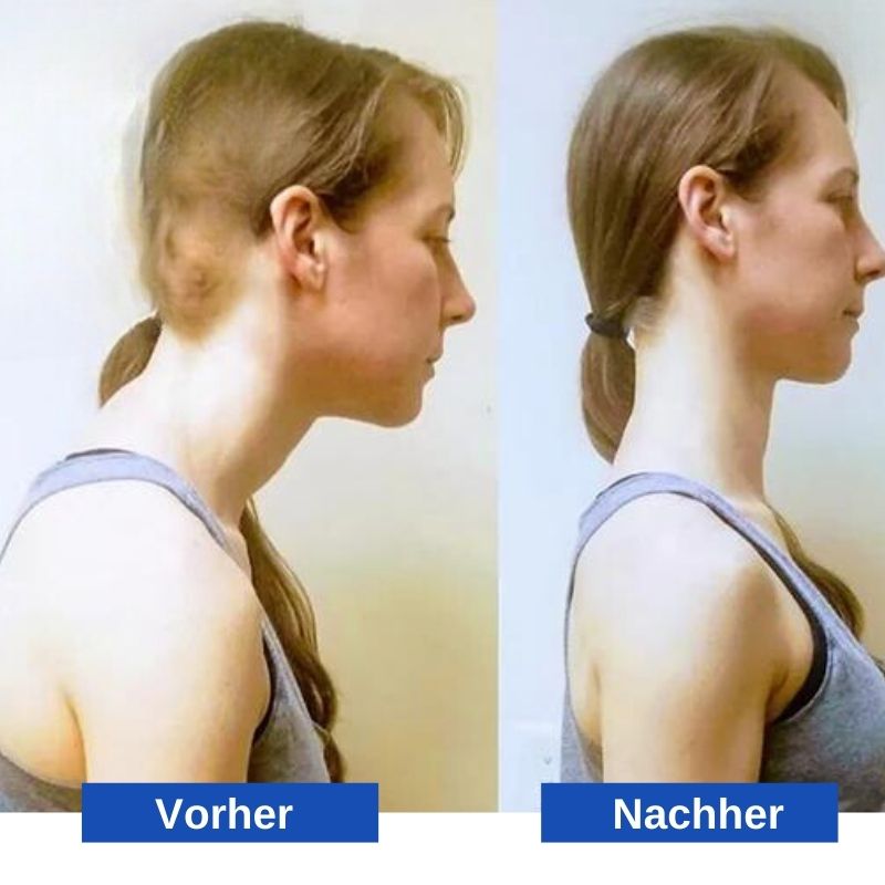 HalsEase™ | Tragbarer Nackenstrecker-Tür-Hängemattensystem