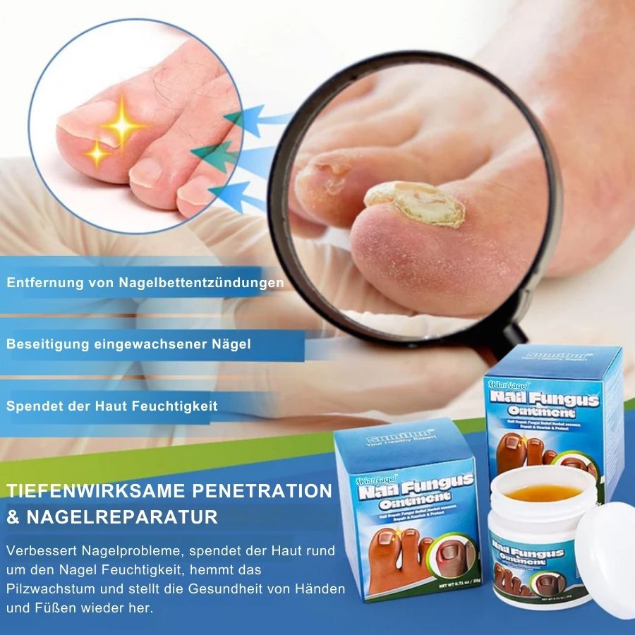 KlarNagel™  | Schnelle Antipilz-Salbe