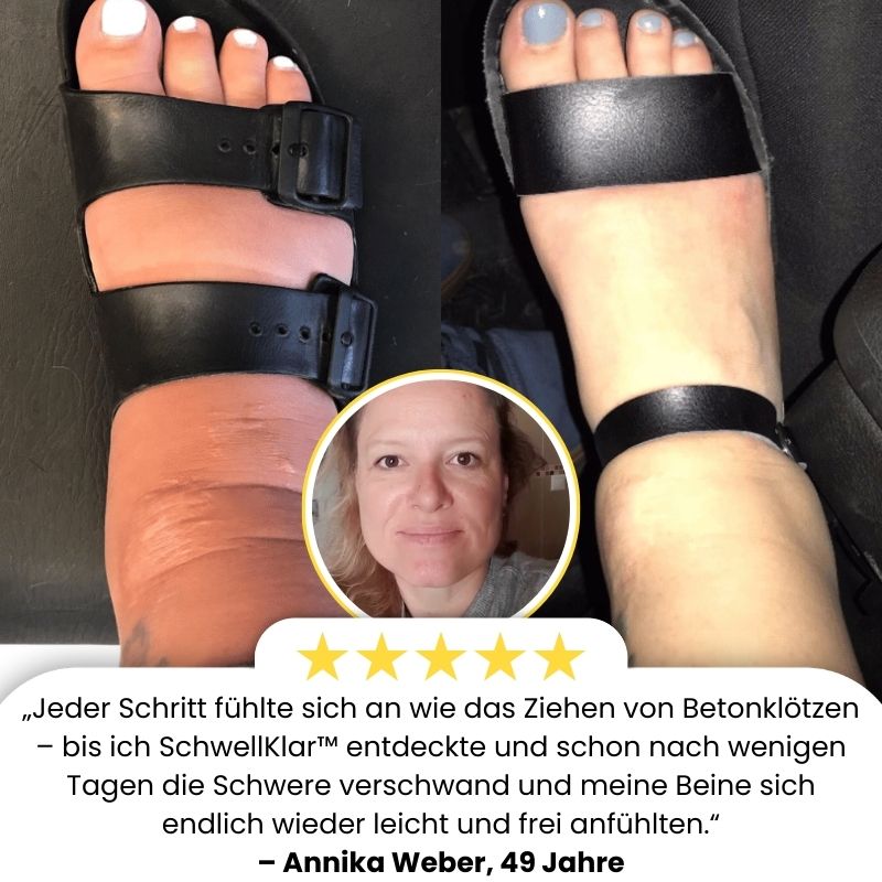 SchwellKlar™ | Anti-Schwellungs- & Slimming-Öl