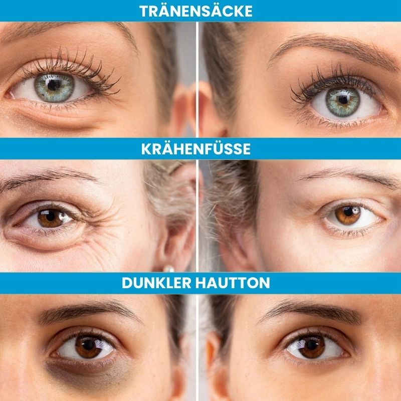 EyeFirm™ - Creme | Reduziert Schwellungen und Fältchen in 5 Minuten
