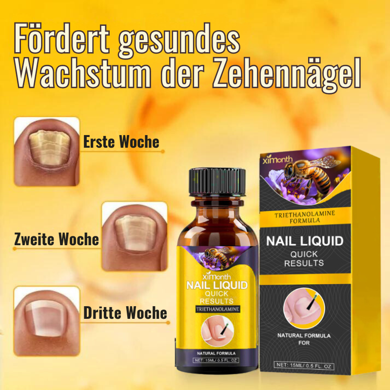 NagelPflege™ | Stellen Ihre hässlichen Nägel in nur 1 Woche wieder her!
