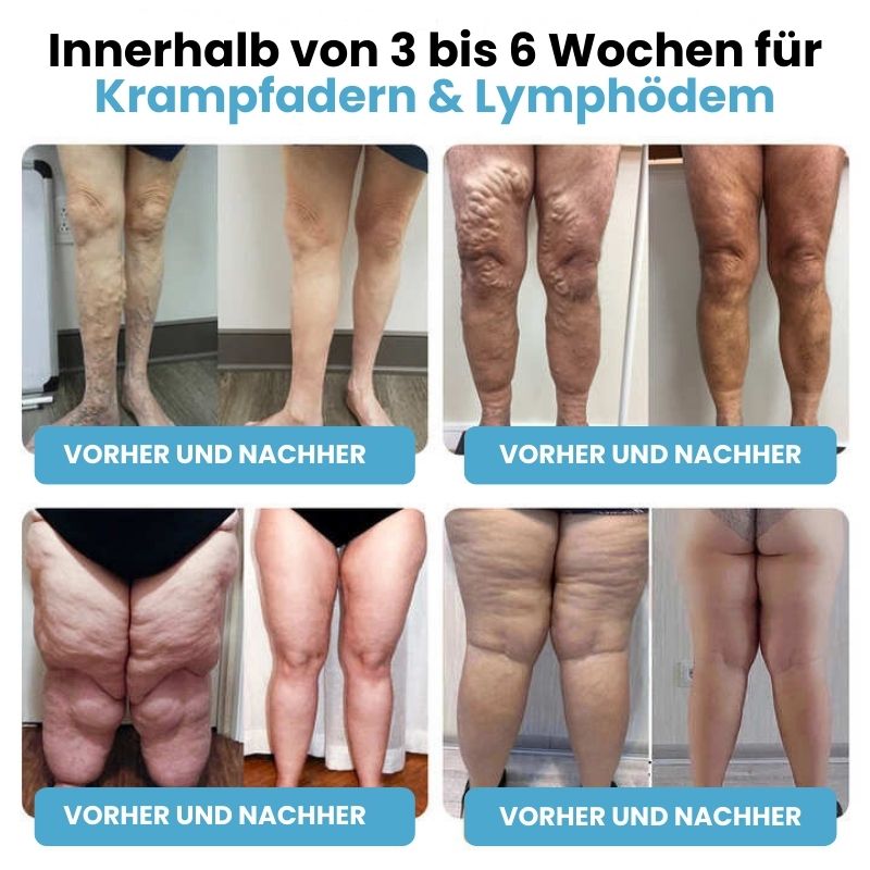 SlimPuls™ | Ultraschall-Detox-Armband für Fettverbrennung & Blutzuckerregulation