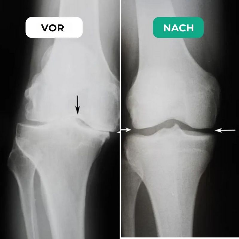 KnieFlex™ | Knie-Massager für alle Größen