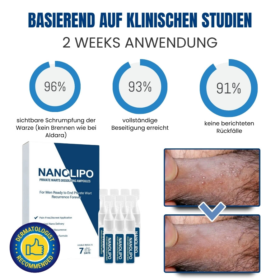 NanoWart™ | Diskrete, wartauflösende Ampullen